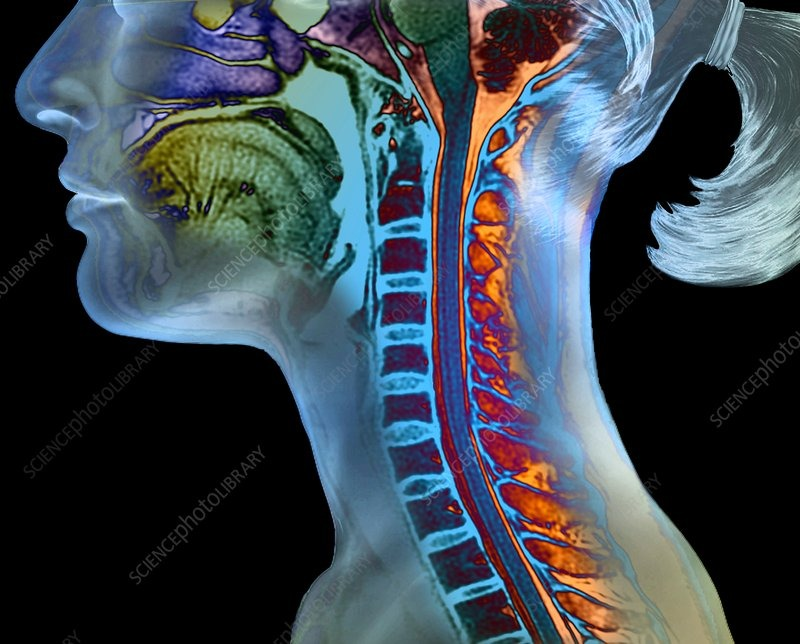 How Aligning the Upper Spine Promotes Healing